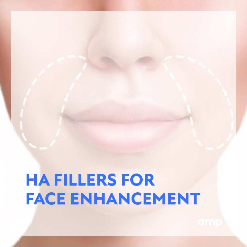 HA FILLERS FOR FACIAL ENHANCEMENTS