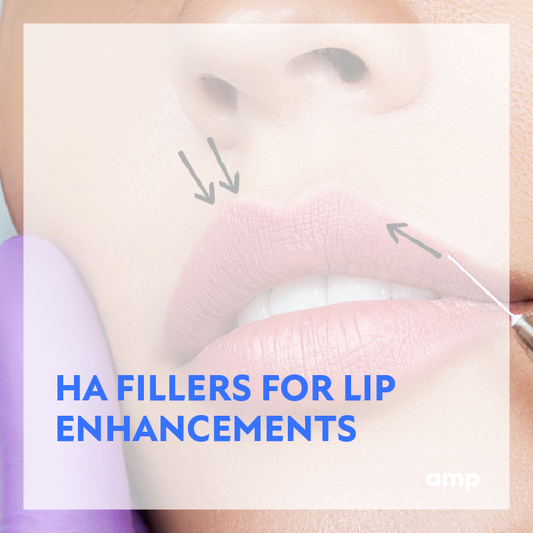 HA FILLERS FOR LIP ENHANCEMENT